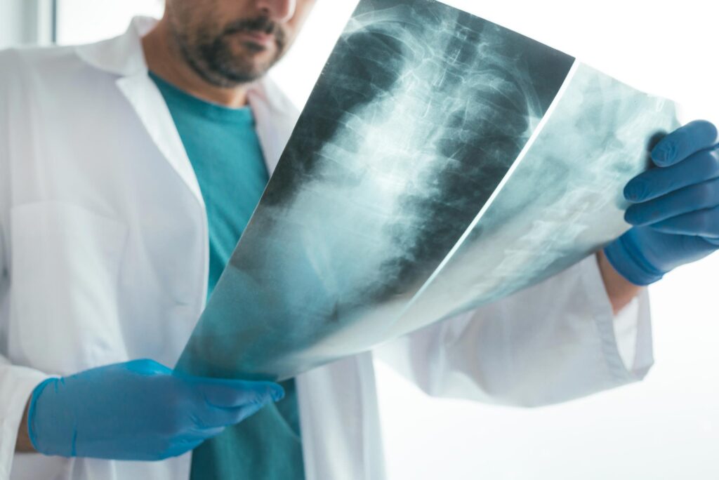 All About Spinal X-Ray Procedure