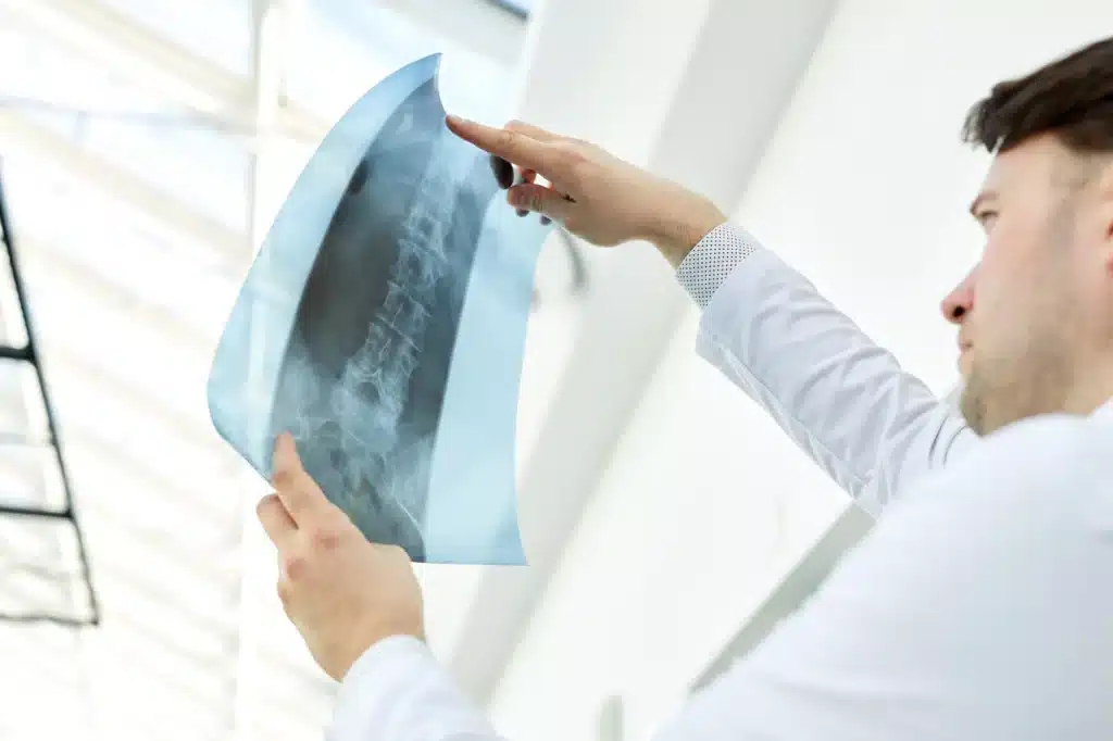 Doctor checking an X-Ray image