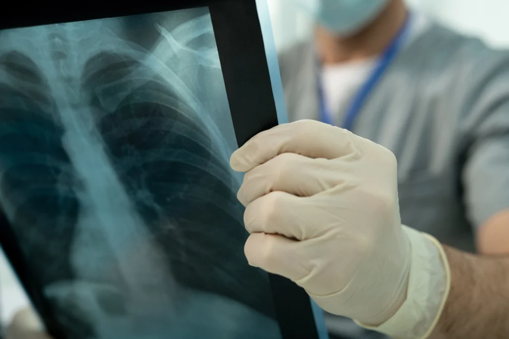 Doctor holding x-ray images