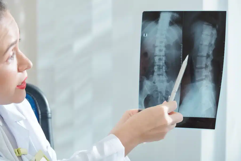 female doctor pointing to a spinal x-ray
