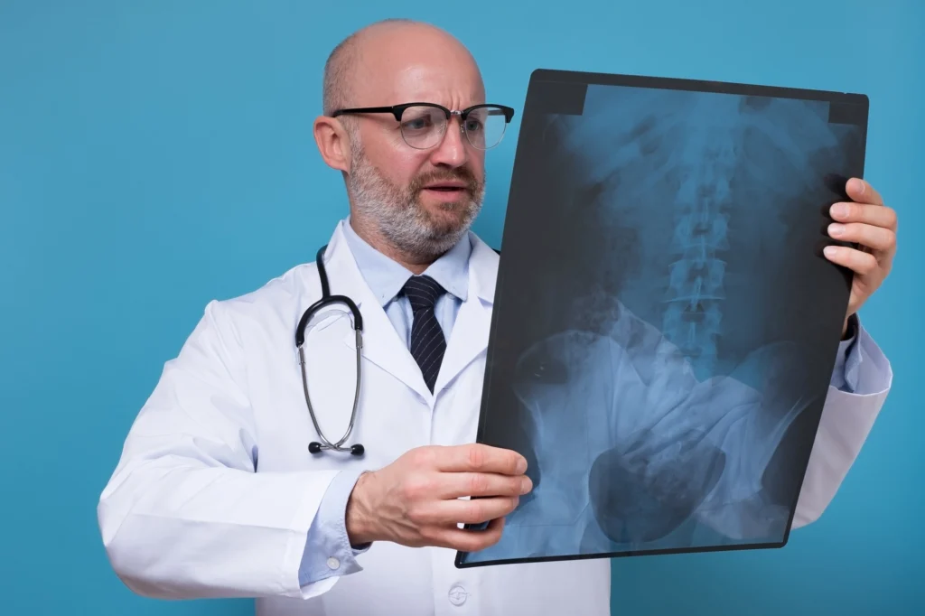 A doctor looking at an x-ray image of a spine