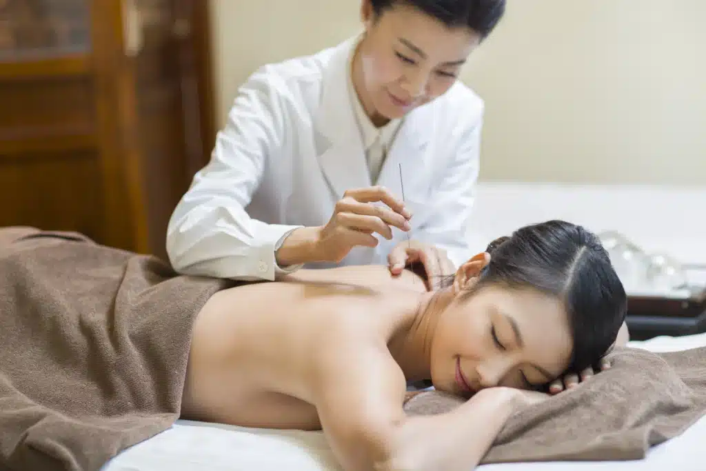 Young woman receiving acupuncture treatment