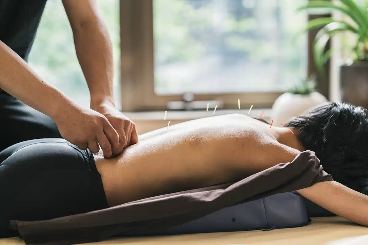 Acupuncture and Trigger Points: The Healing Link