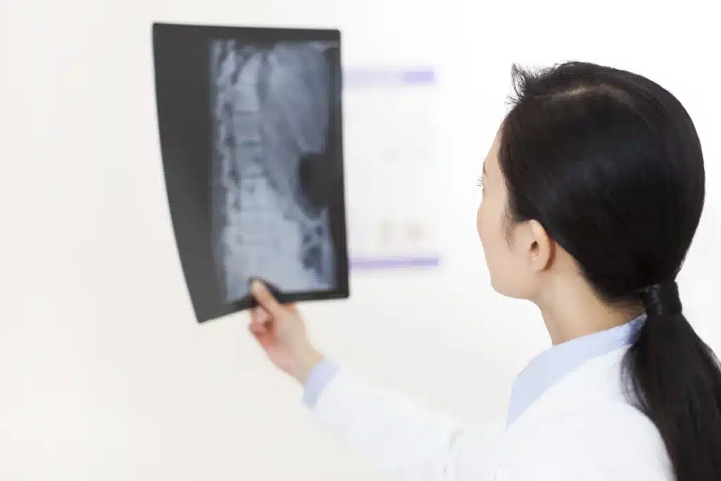 spine fusion surgery