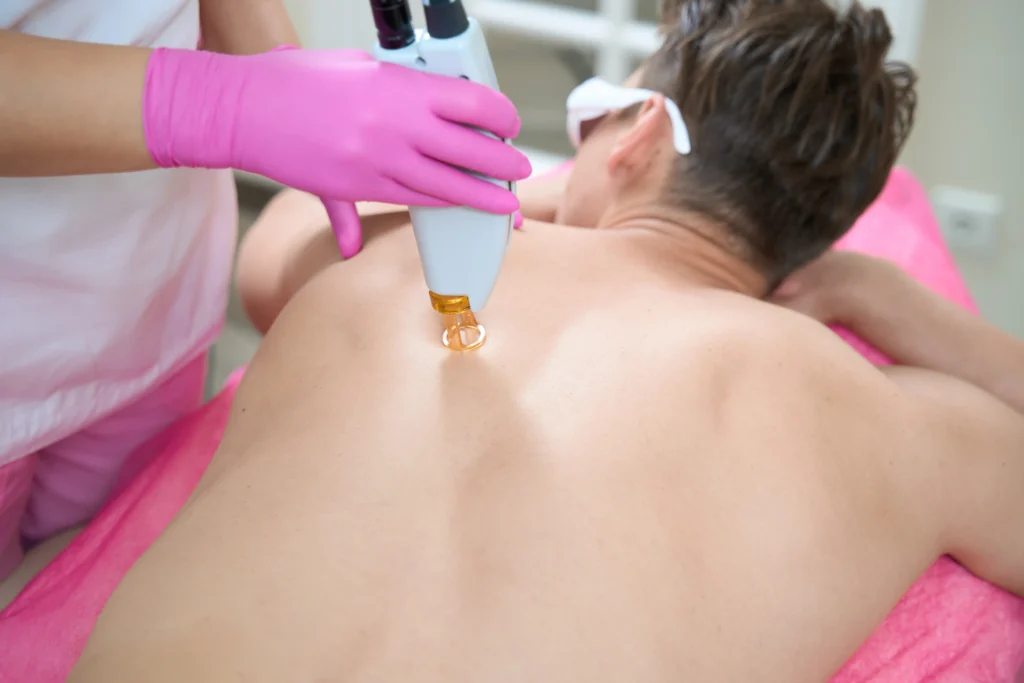 Cosmetology professional using laser technology for back pain relief treatment.