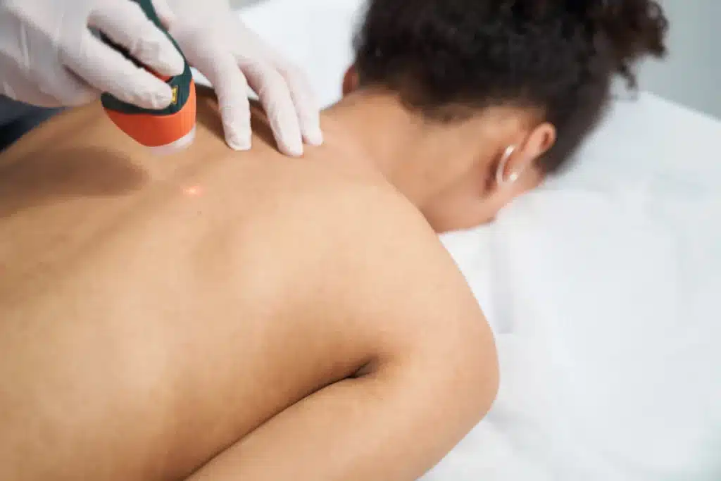 Close-up of a woman receiving back pain laser treatment in a clinic.