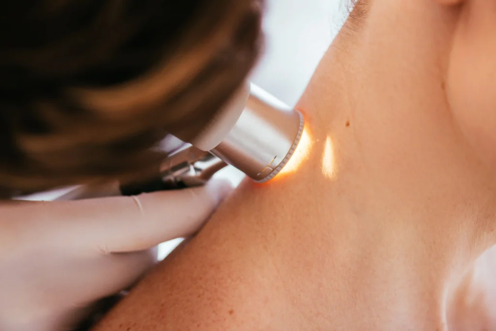 Dermatologist using a device to provide targeted neck pain laser treatment on a patient.