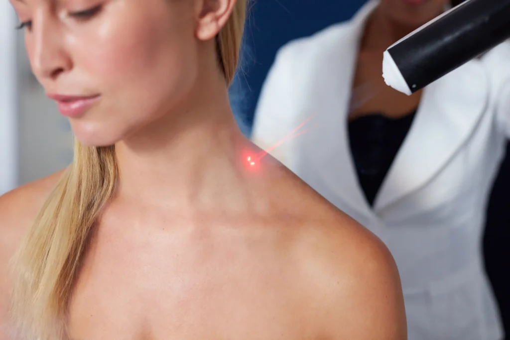 Cryotherapy laser session for neck pain relief showcasing innovative treatment approaches.